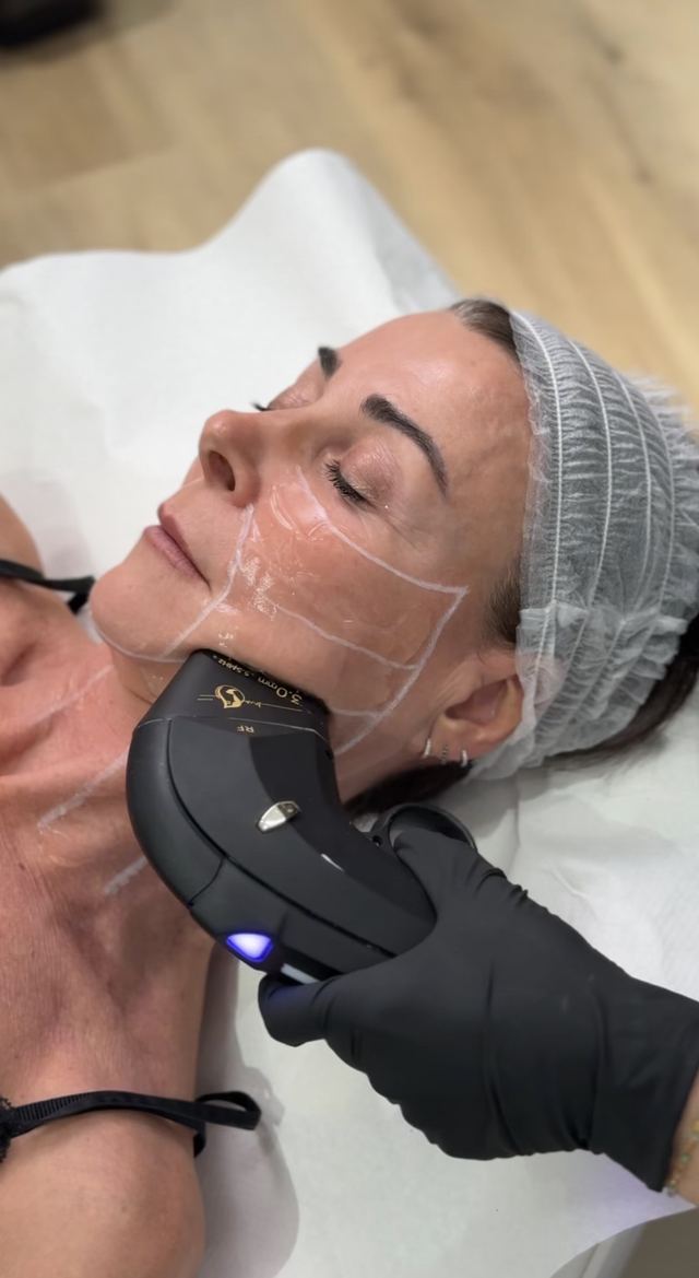 Facial completo + cuello + papada